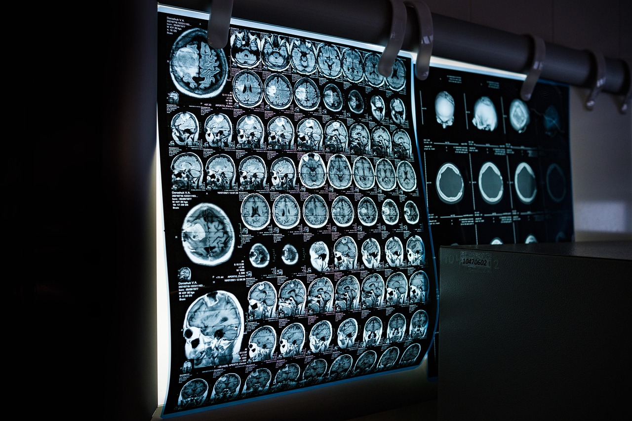 PET CT scanner imaging