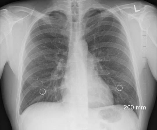 x-ray machine radiology